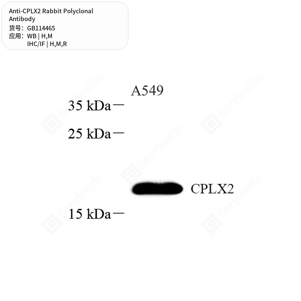 Антитела первичные, поликлональные кролика к CPLX2 крысы, мыши, человека, 100 мкл
