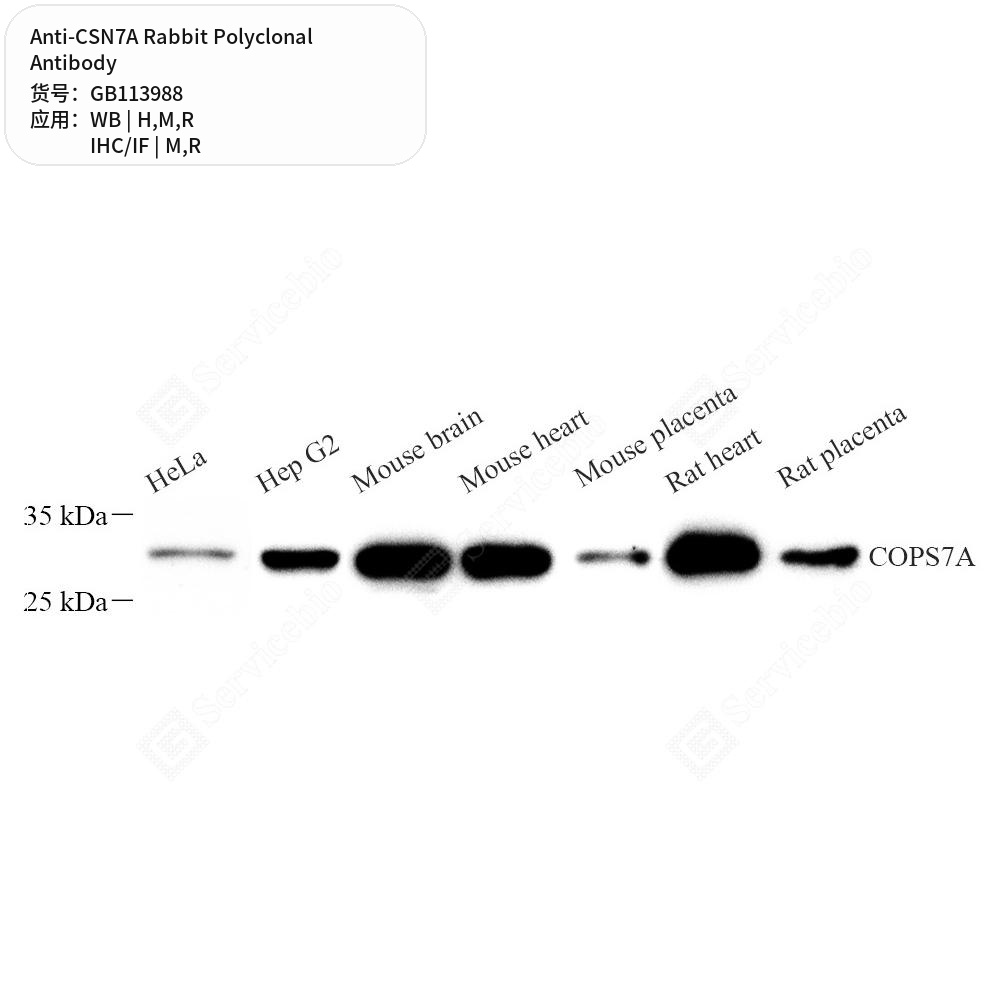 Антитела первичные, поликлональные кролика к CSN7A крысы, мыши, человека, 50 мкл