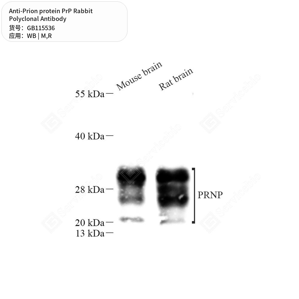 Антитела первичные, поликлональные кролика к Prion protein PrP крысы, мыши, 100 мкл