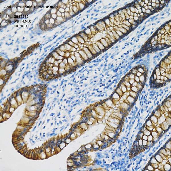 Антитела первичные, моноклональные, Cytokeratin 18, 100 мкл
