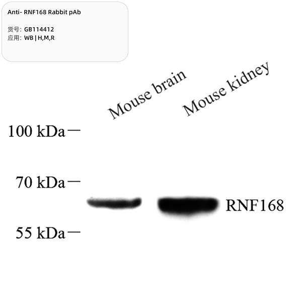 Антитела первичные, поликлональные, RNF168, 100 мкл
