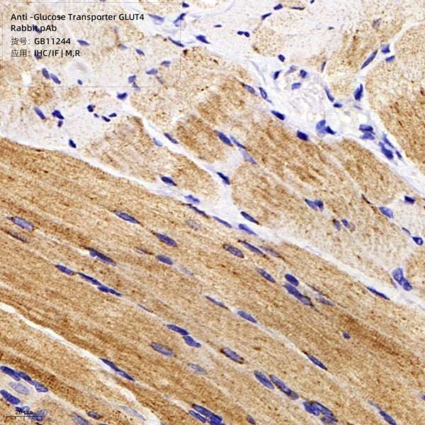 Антитела первичные, поликлональные, Glucose Transporter GLUT4, 100 мкл