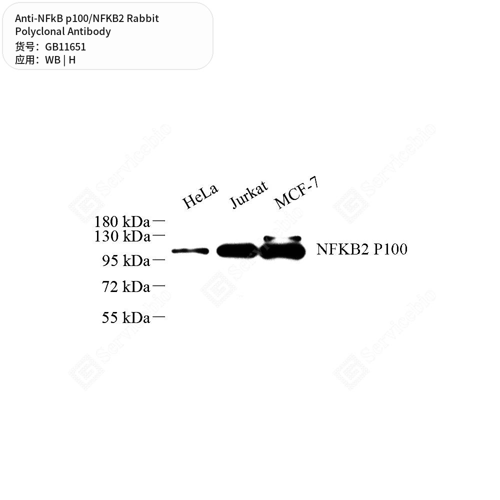 Антитела первичные, поликлональные кролика к NFkB p100/NFKB2 человека, 50 мкл