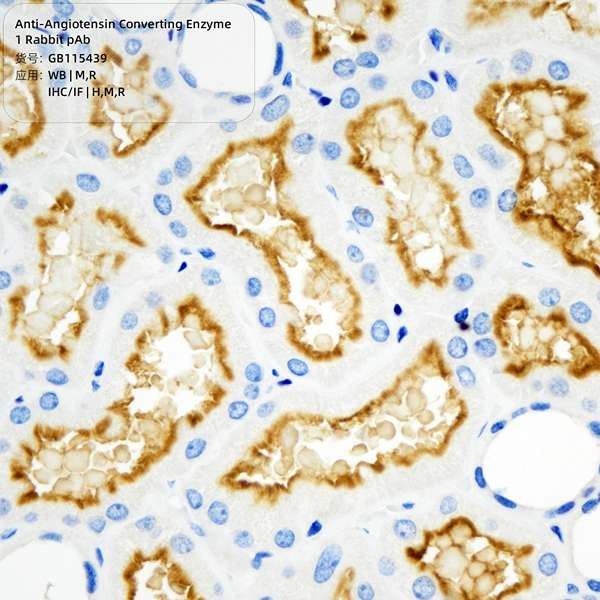 Антитела первичные, поликлональные, Angiotensin Converting Enzyme 1, 100 мкл