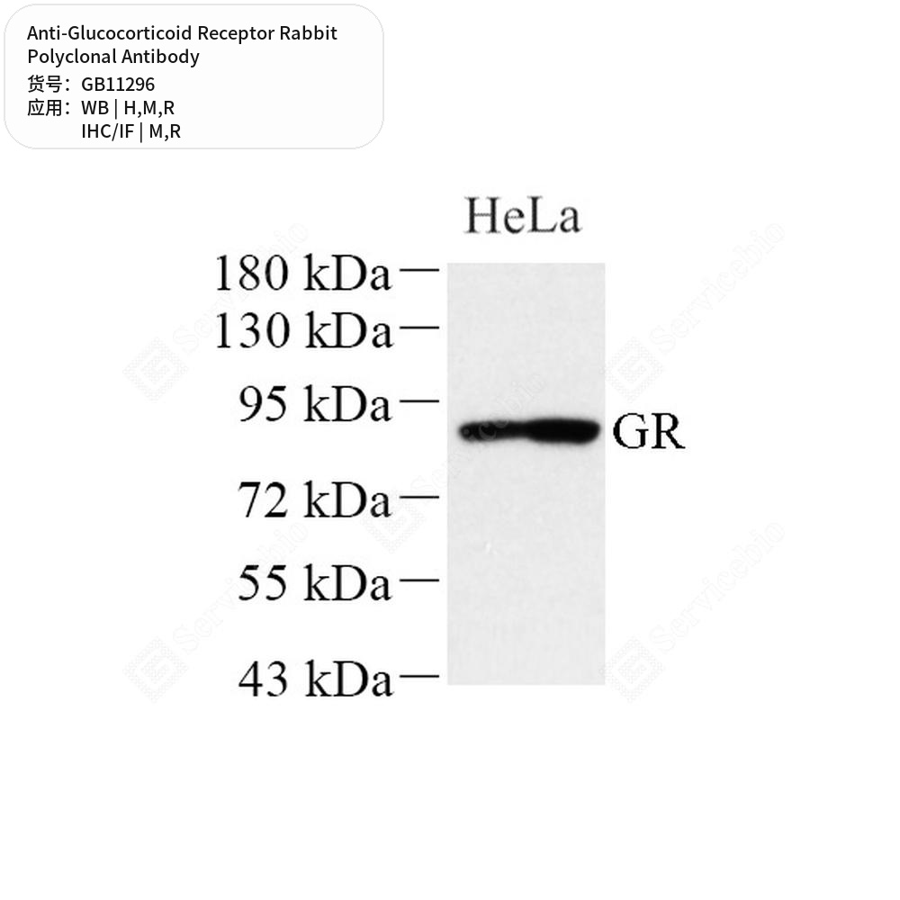 Антитела первичные, поликлональные кролика к Glucocorticoid Receptor крысы, мыши, человека, 100 мкл