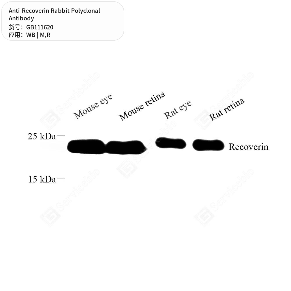 Антитела первичные, поликлональные кролика к Recoverin крысы, мыши, 100 мкл