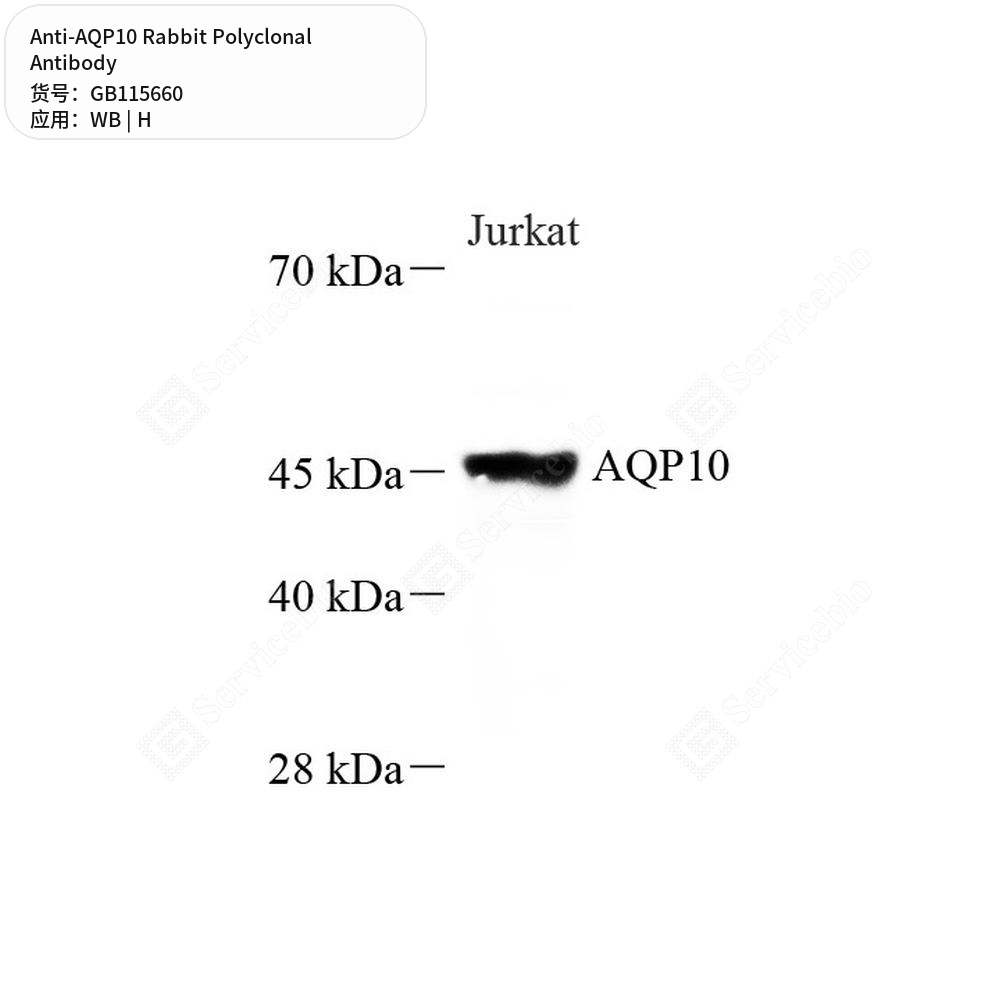 Антитела первичные, поликлональные кролика к AQP10 человека, 100 мкл