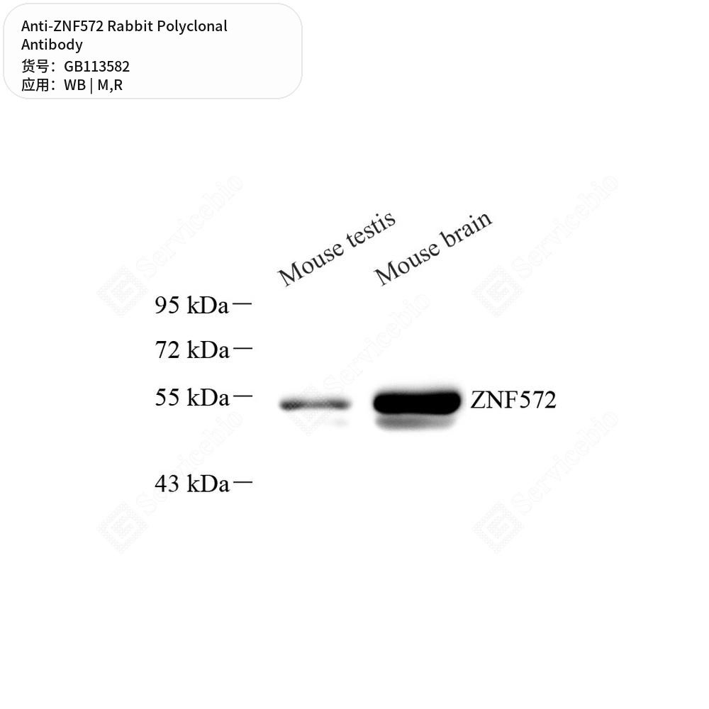 Антитела первичные, поликлональные кролика к ZNF572 крысы, мыши, 100 мкл