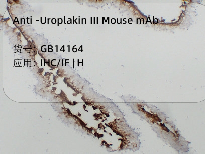 Антитела первичные, моноклональные мыши к Uroplakin III человека, 50 мкл