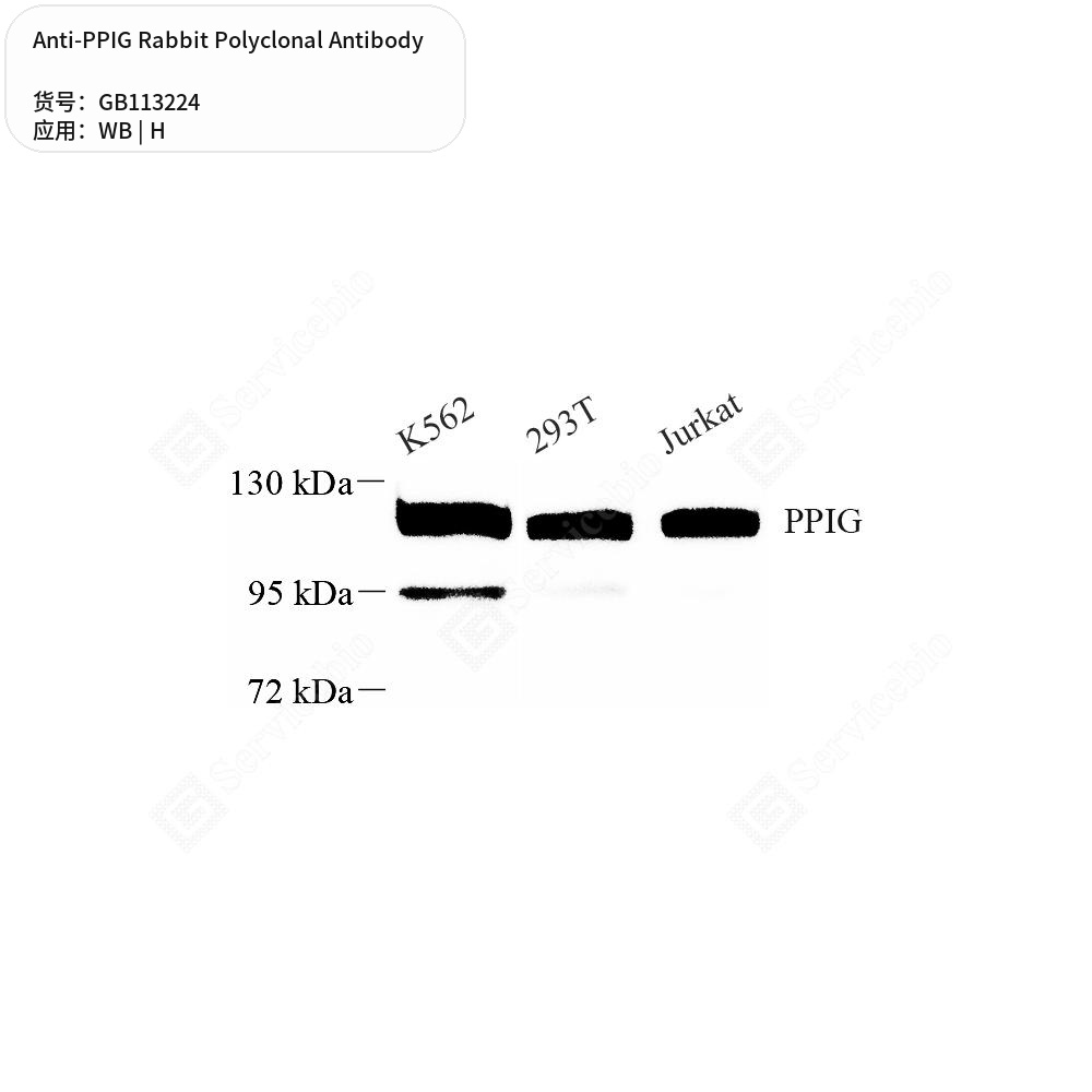 Антитела первичные, поликлональные кролика к PPIG человека, 50 мкл