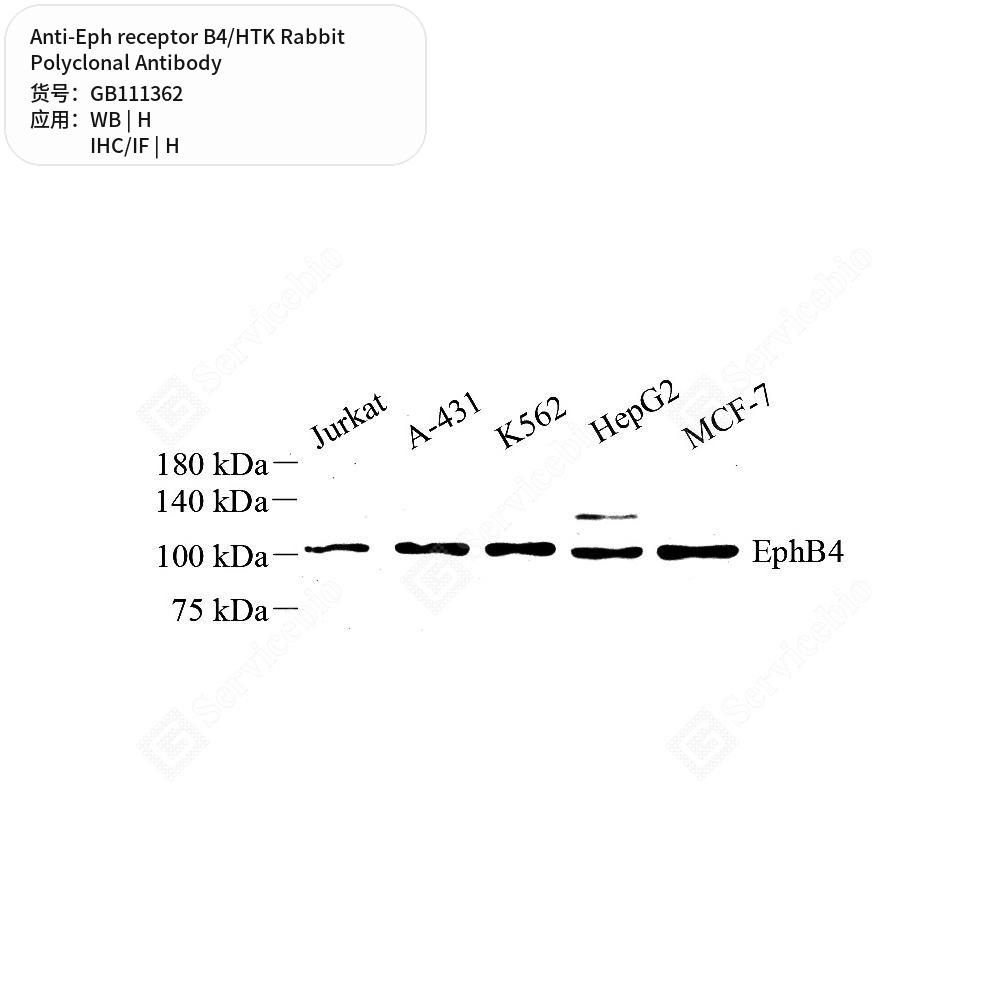 Антитела первичные, поликлональные кролика к Eph receptor B4/HTK человека, 100 мкл