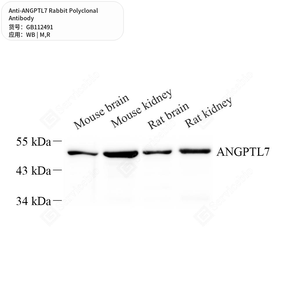 Антитела первичные, поликлональные кролика к ANGPTL7 крысы, мыши, 100 мкл