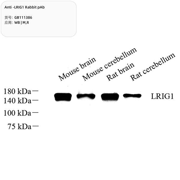 Антитела первичные, поликлональные, LRIG1, 100 мкл
