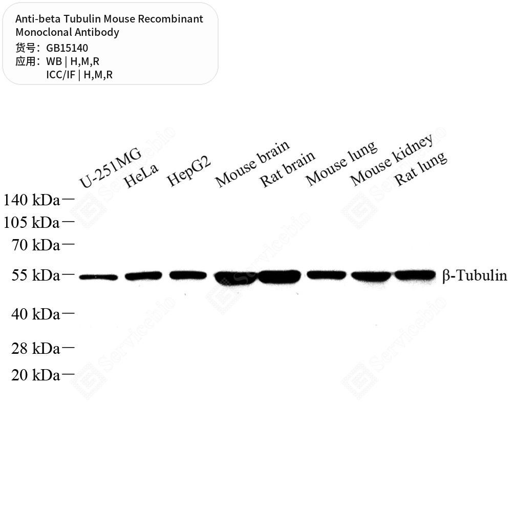 Антитела первичные, моноклональные мыши к beta Tubulin крысы, мыши, человека, 100 мкл