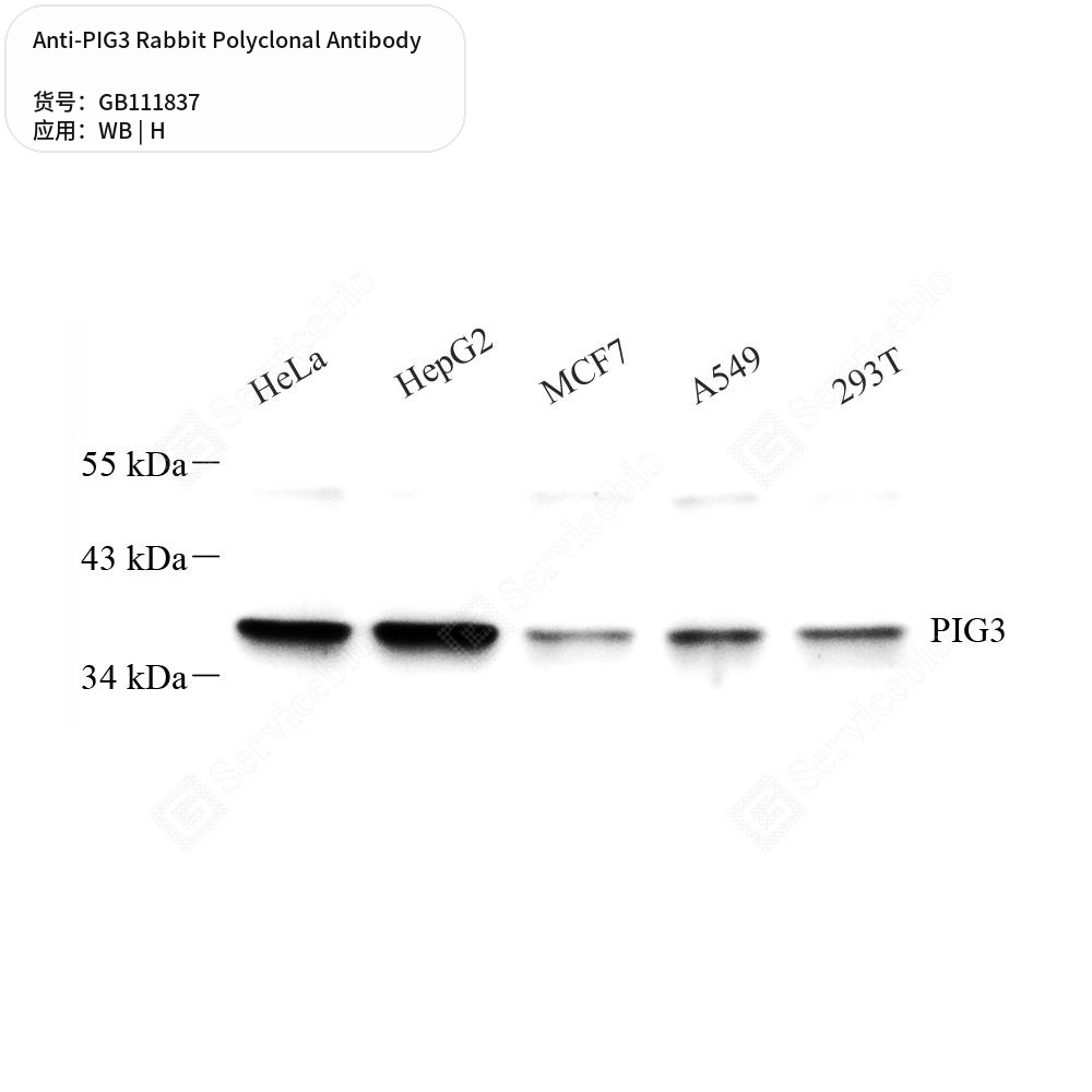 Антитела первичные, поликлональные кролика к PIG3 человека, 50 мкл