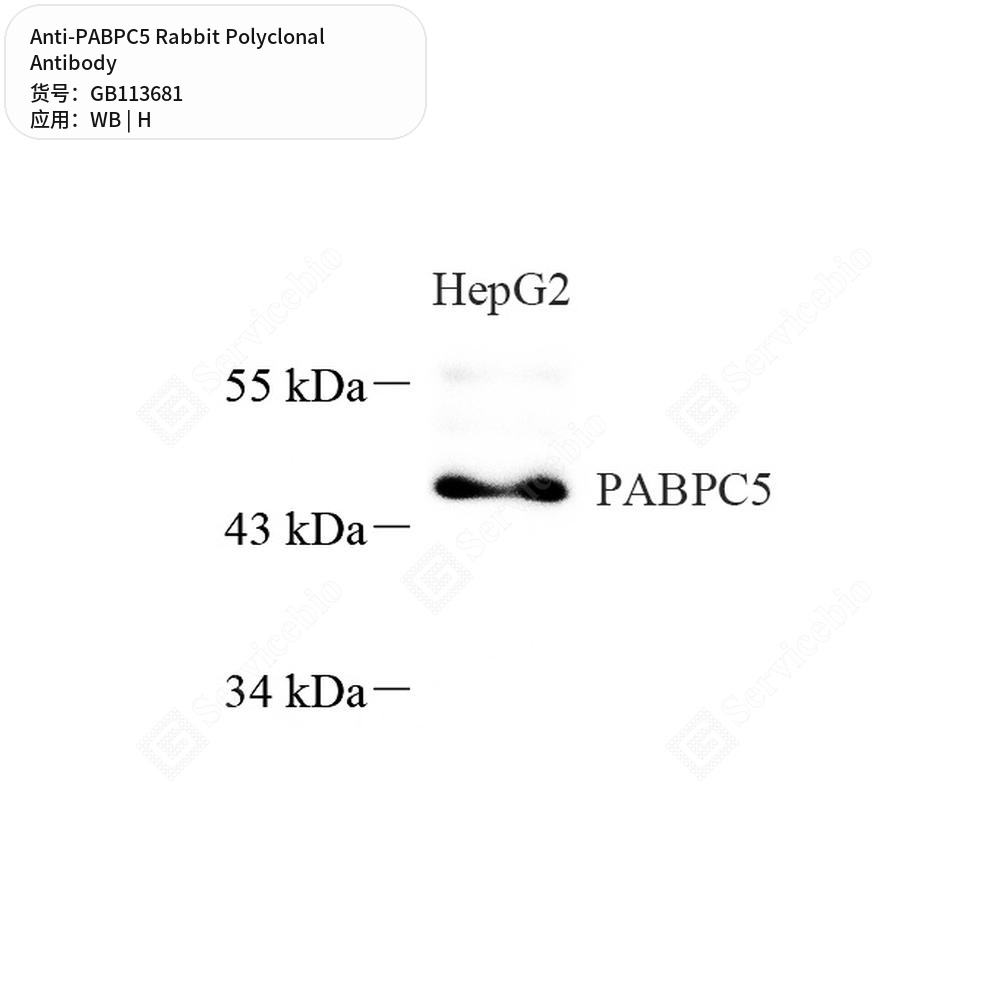 Антитела первичные, поликлональные кролика к PABPC5 человека, 100 мкл