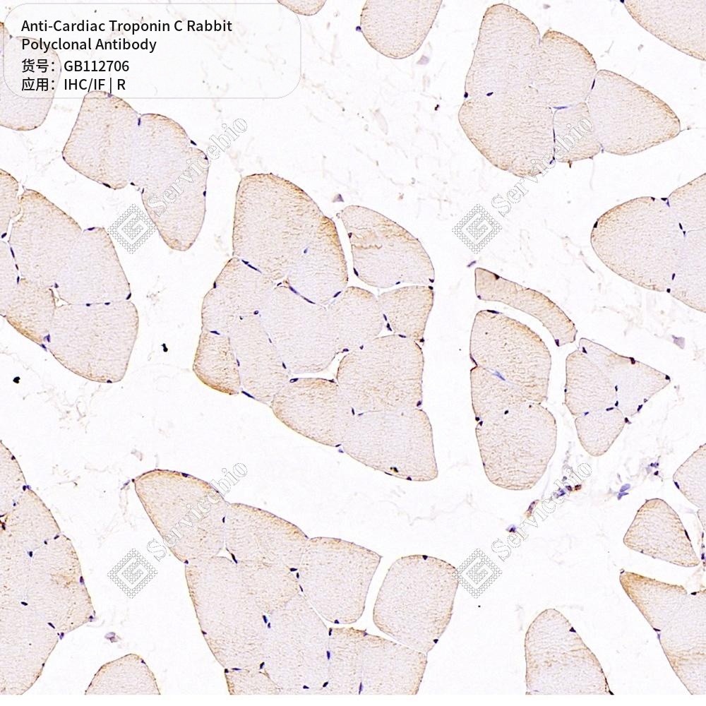 Антитела первичные, поликлональные кролика к Cardiac Troponin C крысы, 100 мкл