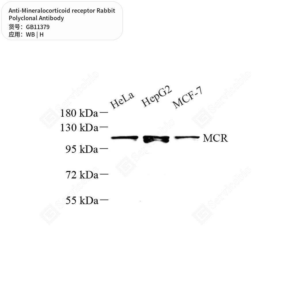 Антитела первичные, поликлональные кролика к Mineralocorticoid receptor человека, 50 мкл