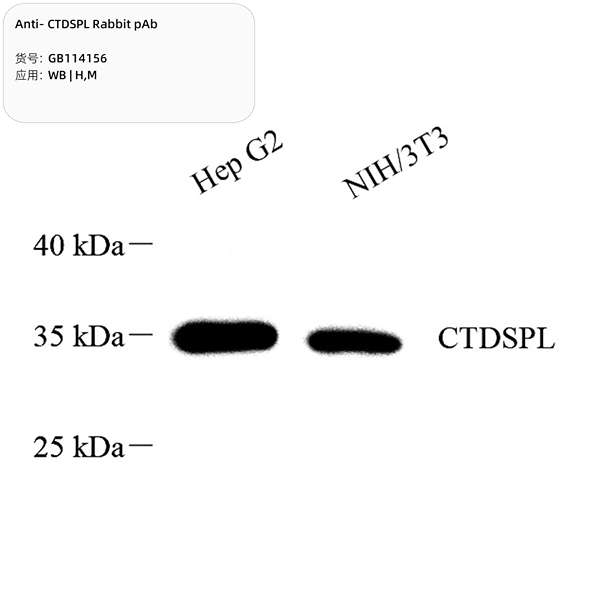 Антитела первичные, поликлональные, CTDSPL, 100 мкл