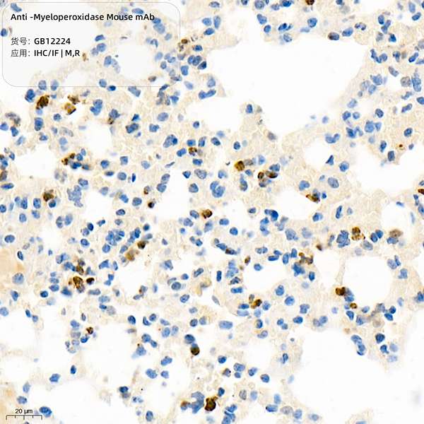 Антитела первичные, моноклональные, Myeloperoxidase, 100 мкл