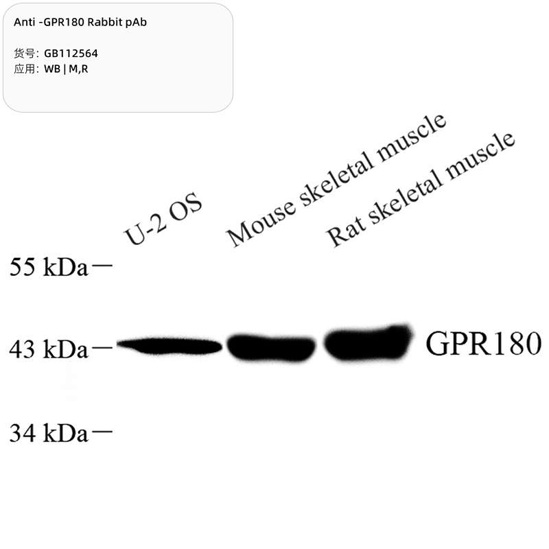Антитела первичные, поликлональные, GPR180, 100 мкл