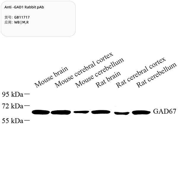 Антитела первичные, поликлональные, GAD1, 100 мкл
