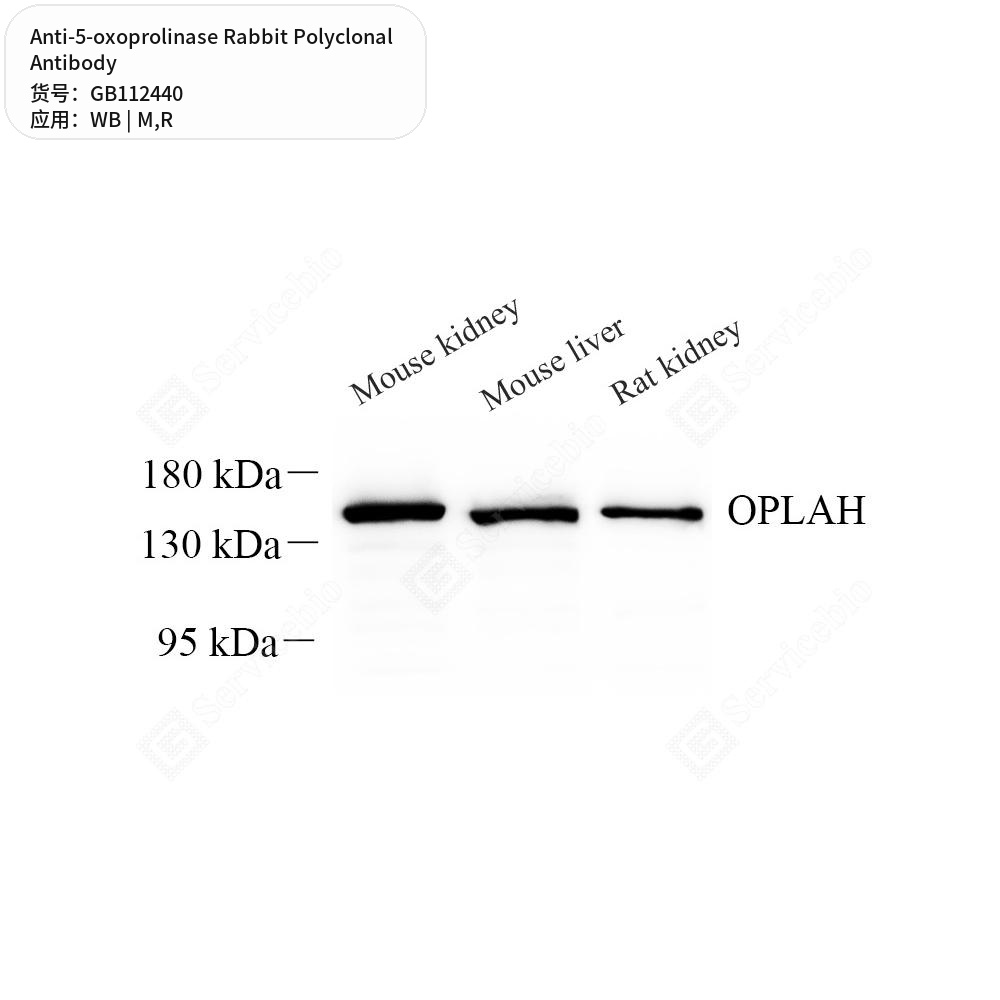 Антитела первичные, поликлональные кролика к 5-oxoprolinase крысы, мыши, 100 мкл