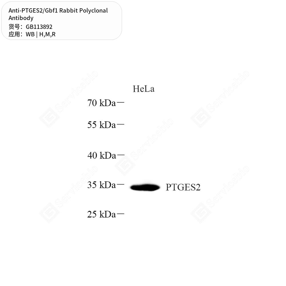 Антитела первичные, поликлональные кролика к PTGES2/Gbf1 крысы, мыши, человека, 100 мкл
