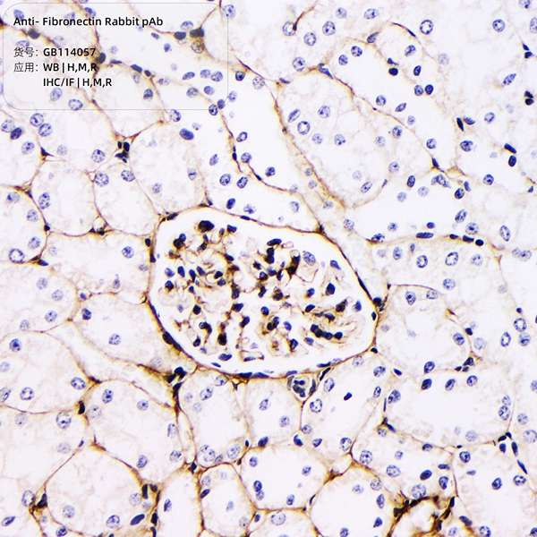 Антитела первичные, поликлональные, Fibronectin, 100 мкл