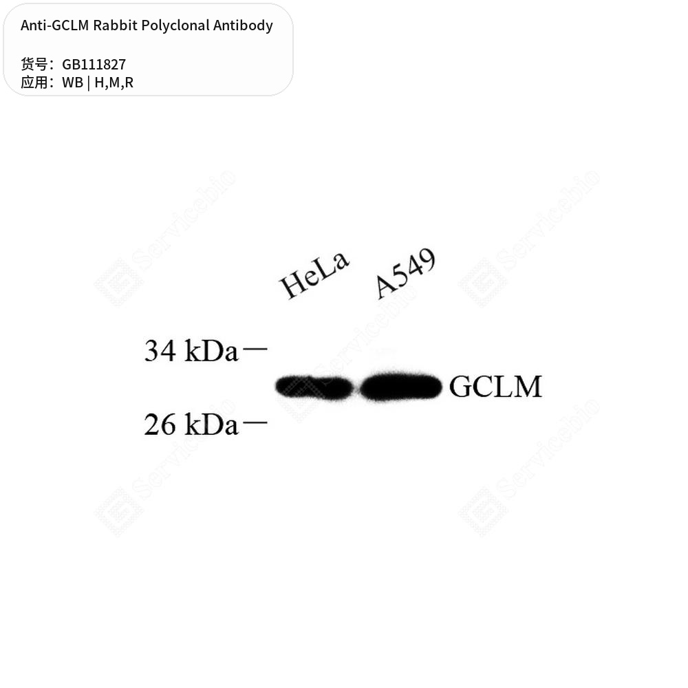 Антитела первичные, поликлональные кролика к GCLM крысы, мыши, человека, 100 мкл