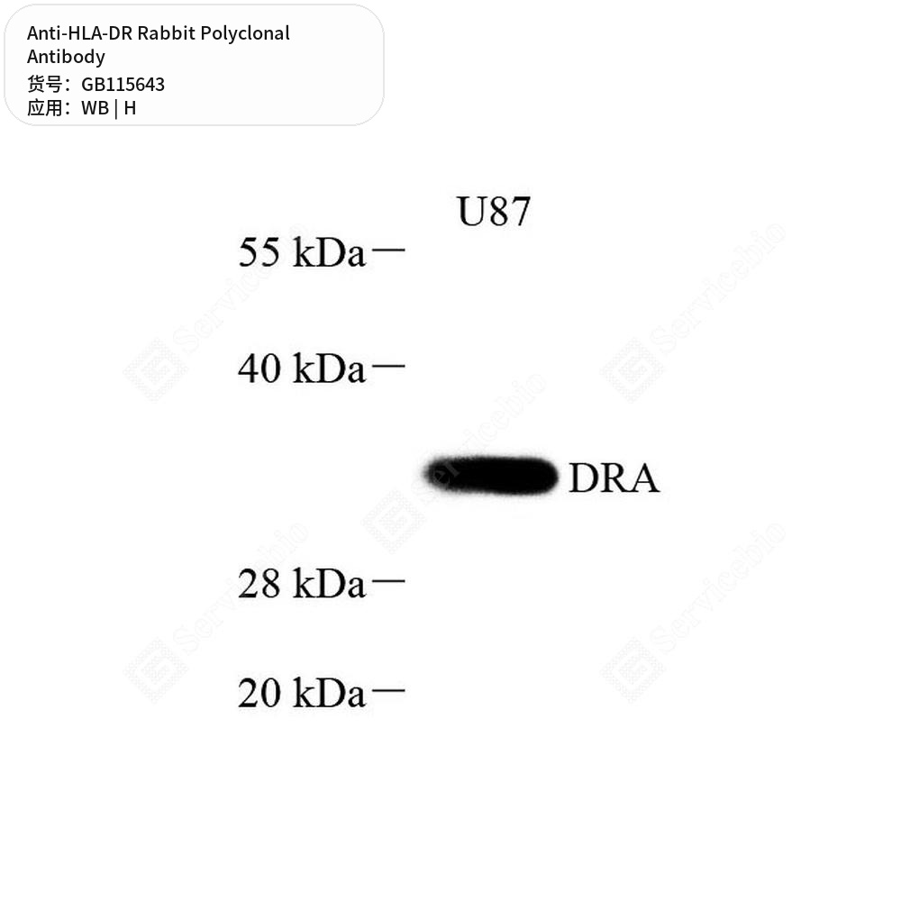 Антитела первичные, поликлональные кролика к HLA-DR человека, 50 мкл