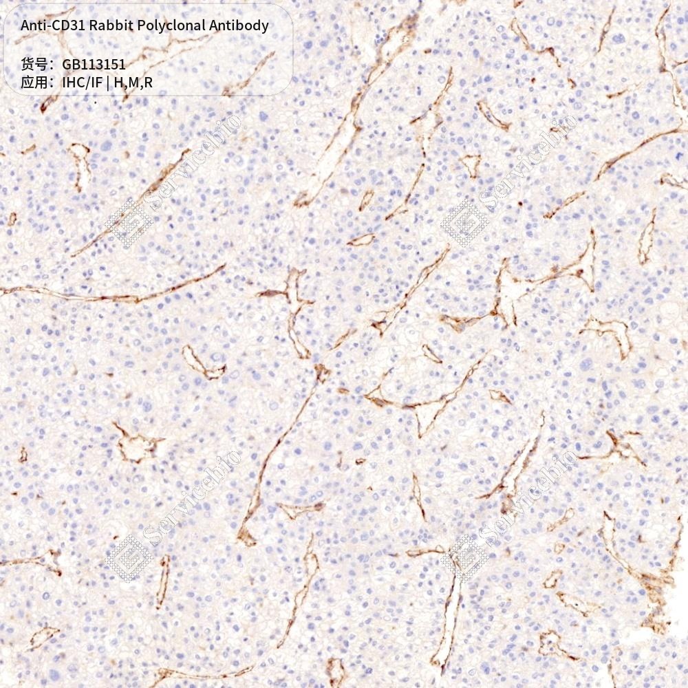 Антитела первичные, поликлональные кролика к CD31 крысы, мыши, человека, 50 мкл
