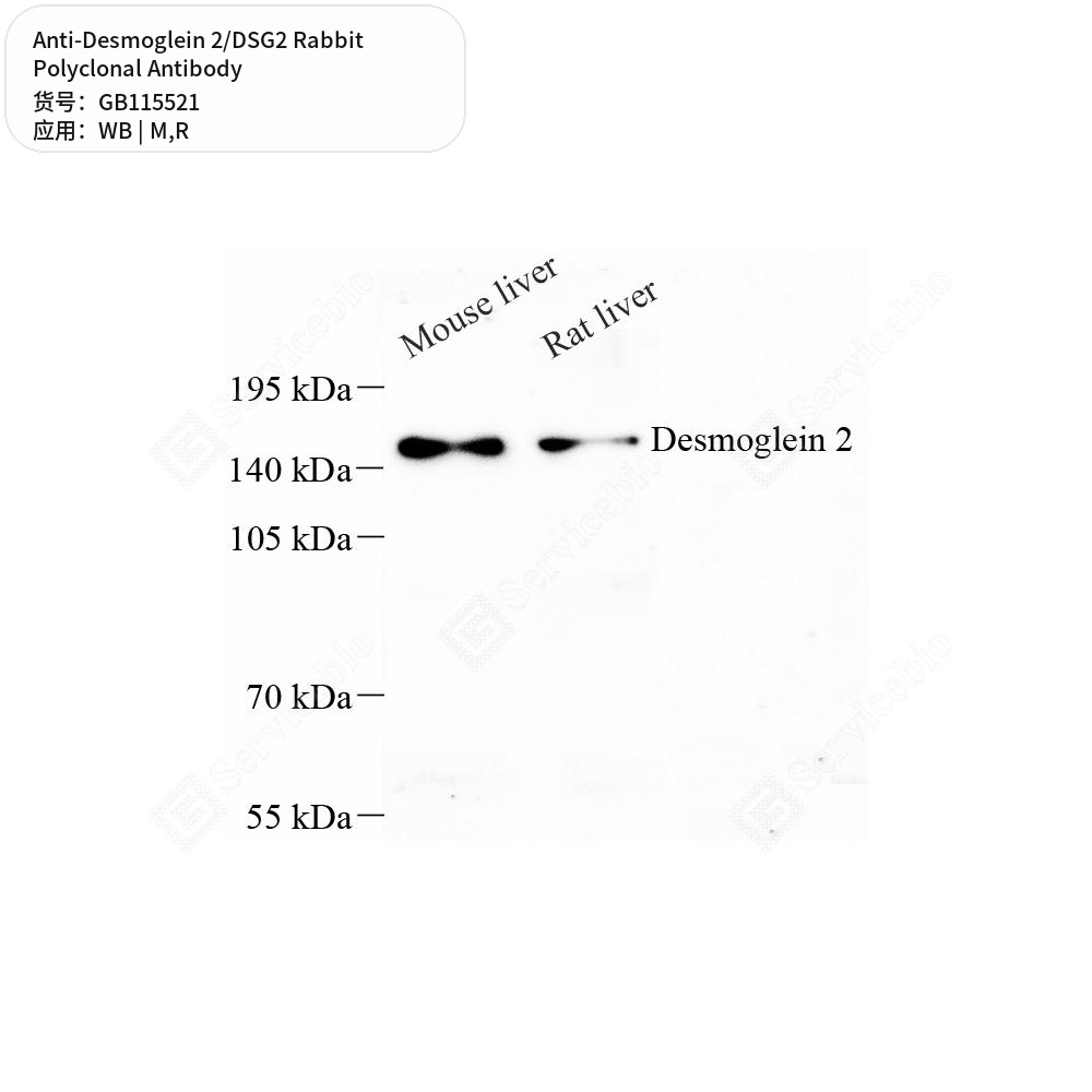 Антитела первичные, поликлональные кролика к Desmoglein 2/DSG2 крысы, мыши, 50 мкл