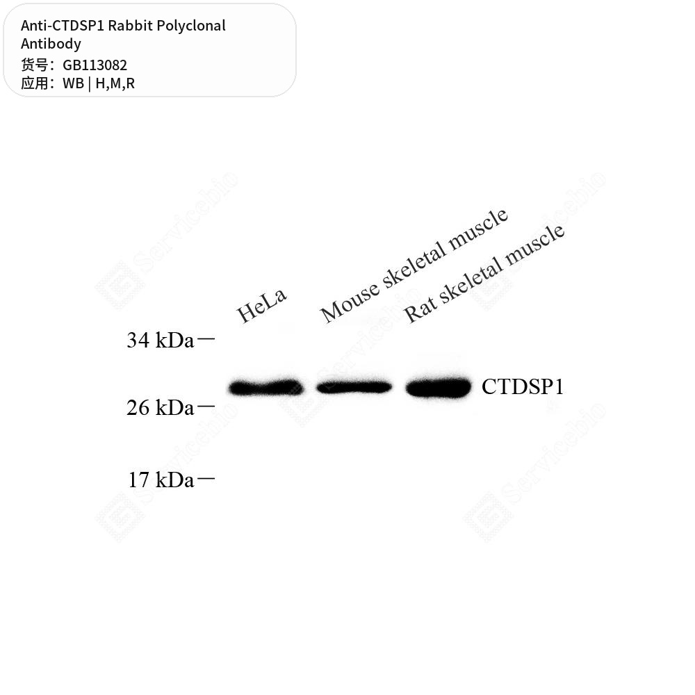 Антитела первичные, поликлональные кролика к CTDSP1 крысы, мыши, человека, 100 мкл