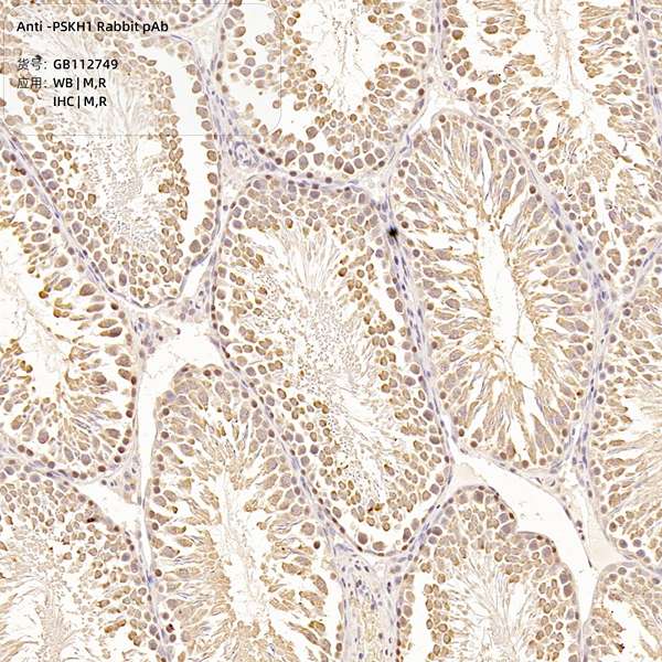 Антитела первичные, поликлональные, PSKH1, 100 мкл
