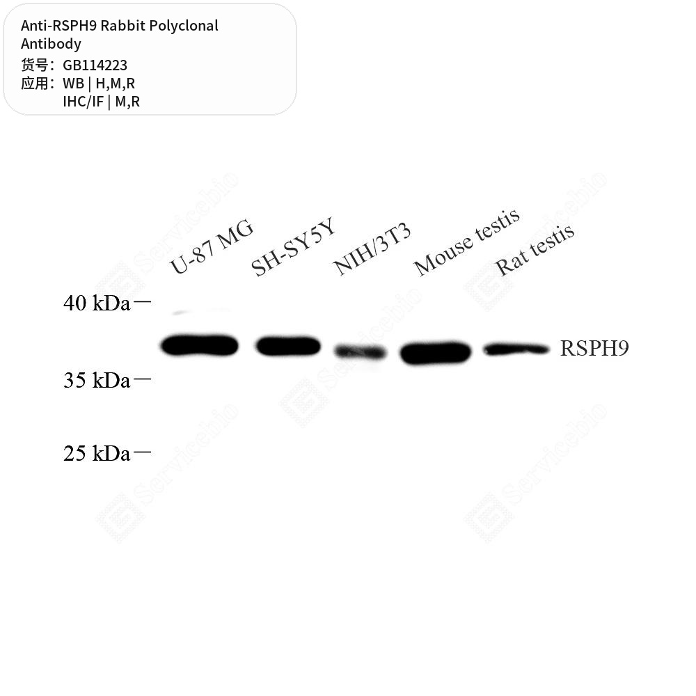 Антитела первичные, поликлональные кролика к RSPH9 крысы, мыши, человека, 50 мкл