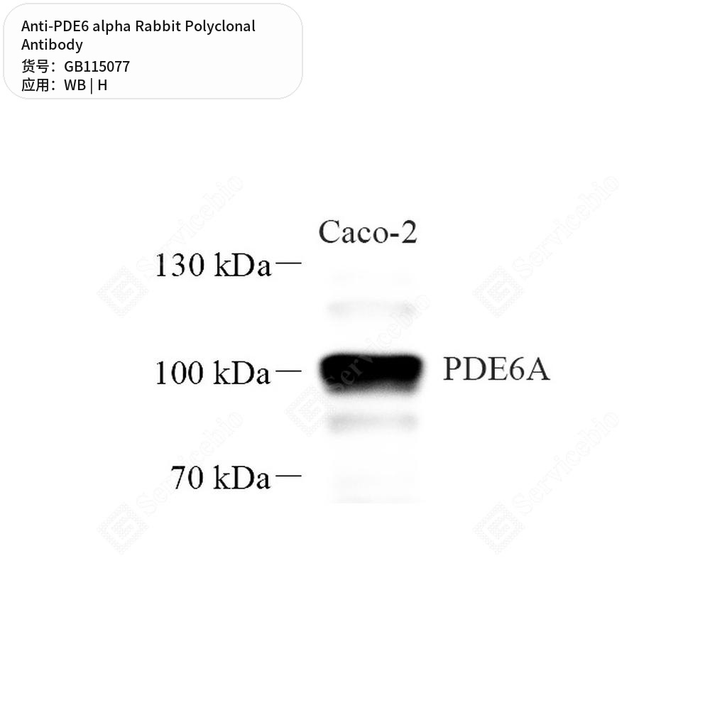 Антитела первичные, поликлональные кролика к PDE6 alpha человека, 50 мкл