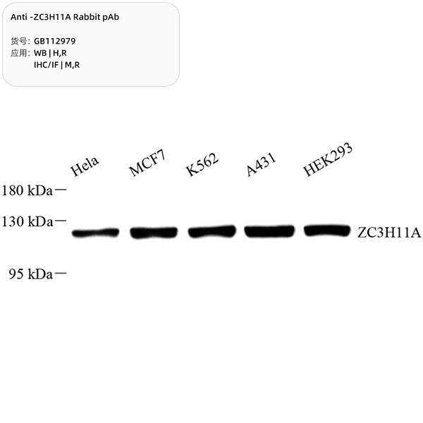 Антитела первичные, поликлональные, ZC3H11A, 100 мкл