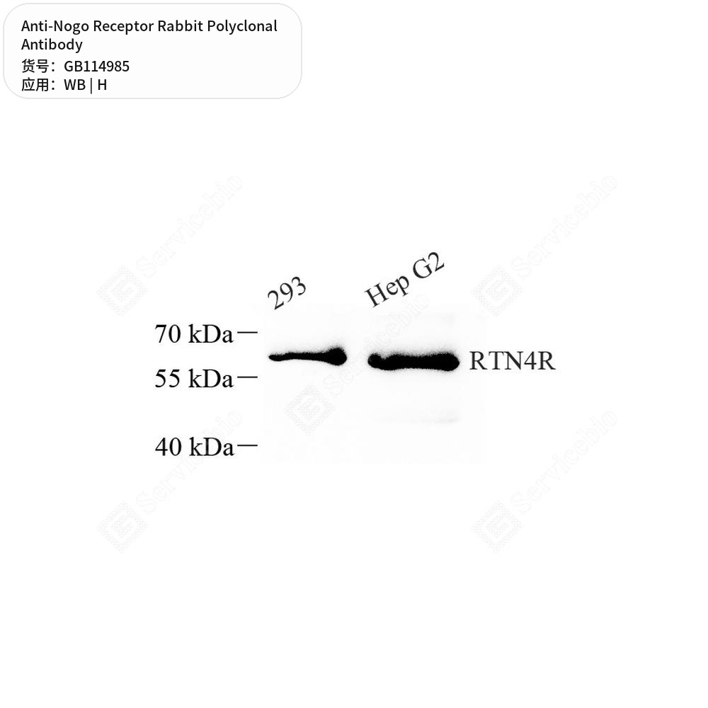 Антитела первичные, поликлональные кролика к Nogo Receptor человека, 100 мкл