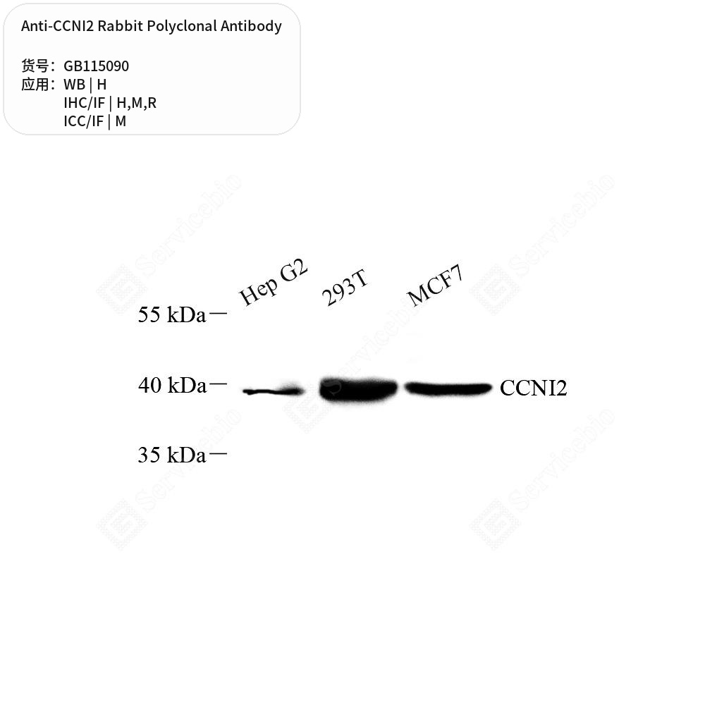 Антитела первичные, поликлональные кролика к CCNI2 крысы, мыши, человека, 50 мкл