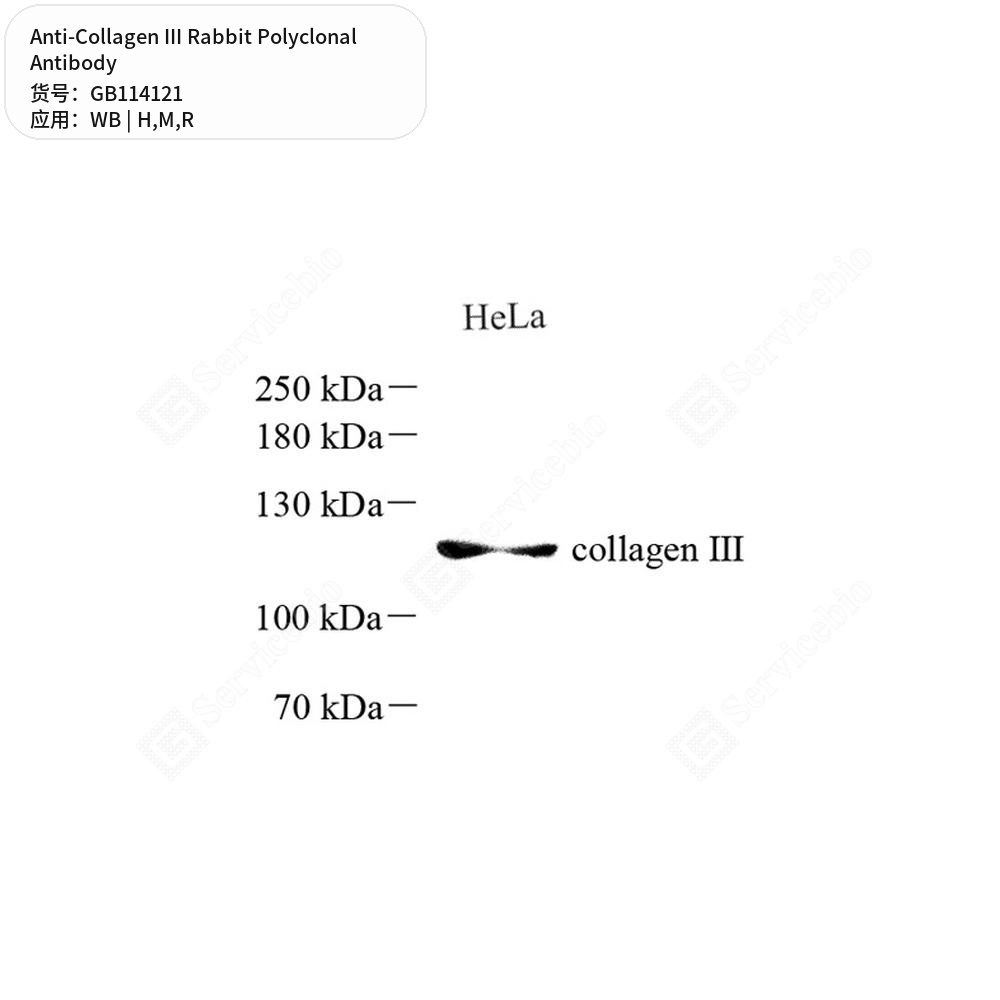 Антитела первичные, поликлональные кролика к Collagen III крысы, мыши, человека, 100 мкл