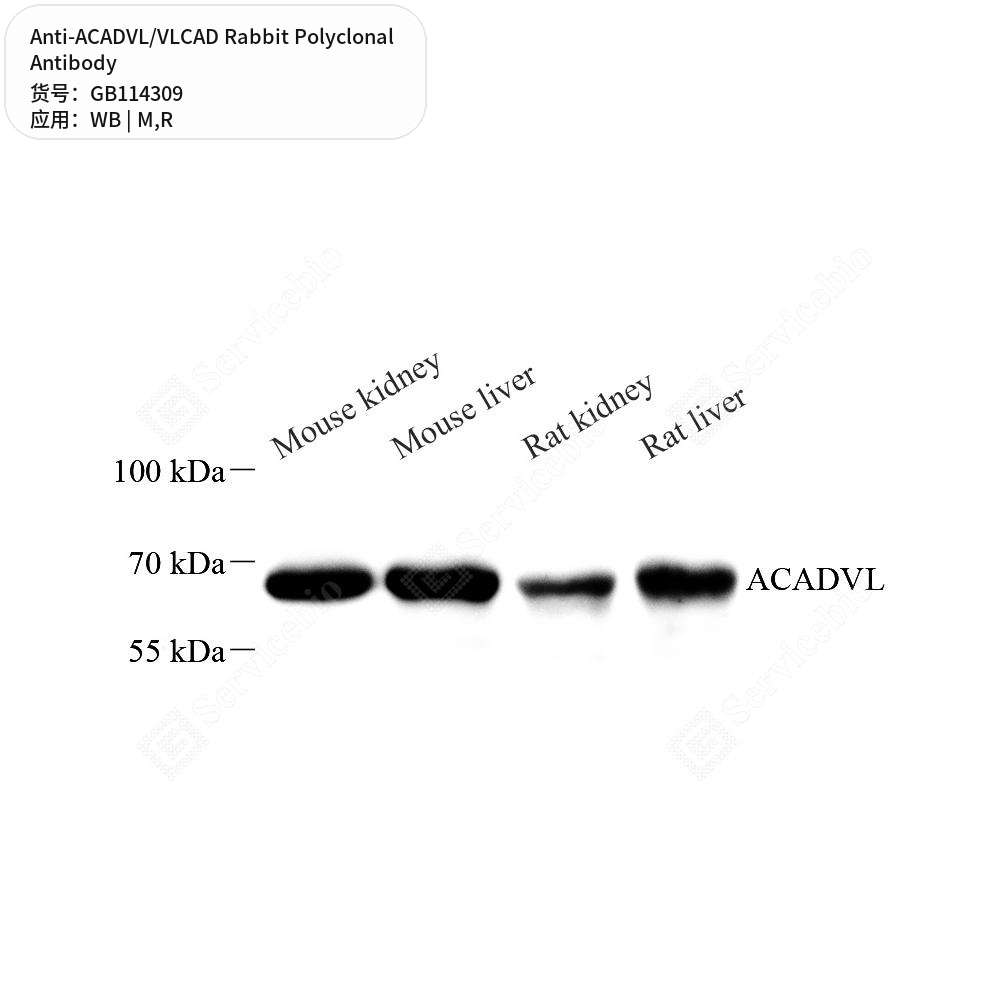 Антитела первичные, поликлональные кролика к ACADVL/VLCAD крысы, мыши, 50 мкл