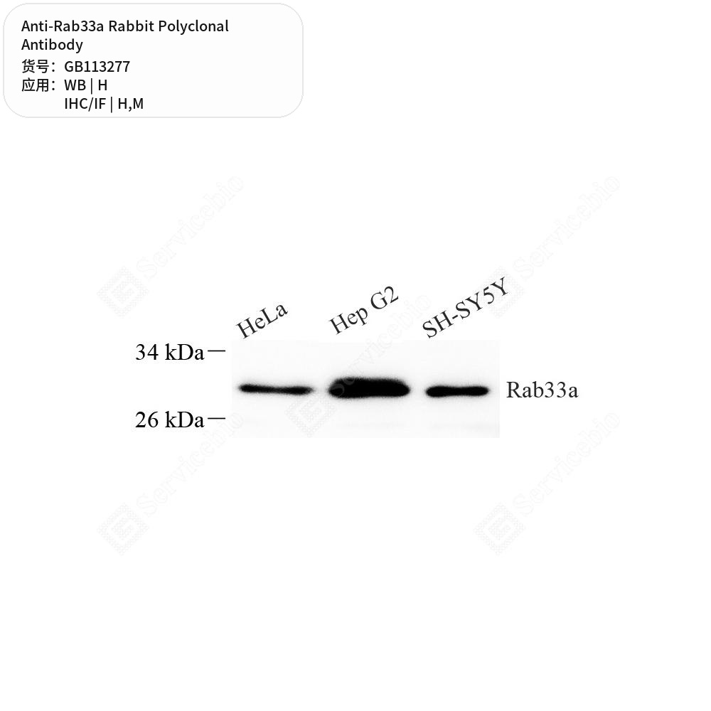 Антитела первичные, поликлональные кролика к Rab33a мыши, человека, 50 мкл
