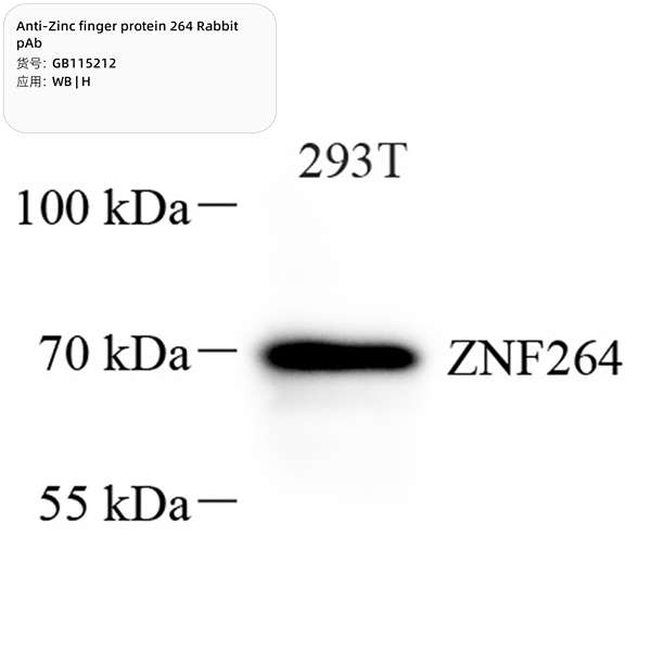 Антитела первичные, поликлональные, Zinc finger protein 264, 100 мкл