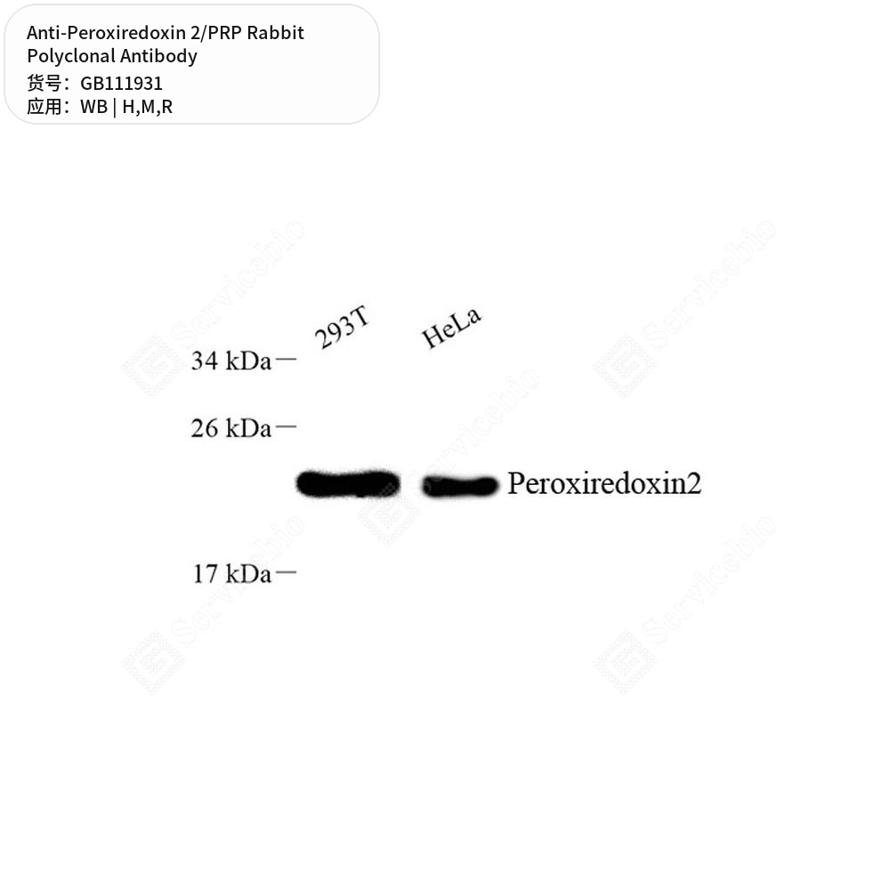 Антитела первичные, поликлональные кролика к Peroxiredoxin 2/PRP крысы, мыши, человека, 100 мкл