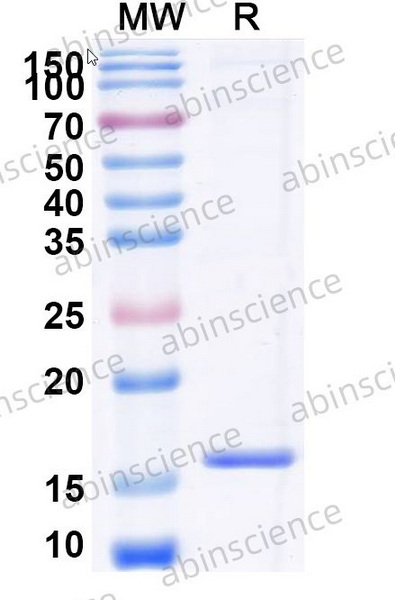 Наноантитела CXCR7/ACKR3 (SAA0795), 100 мкг