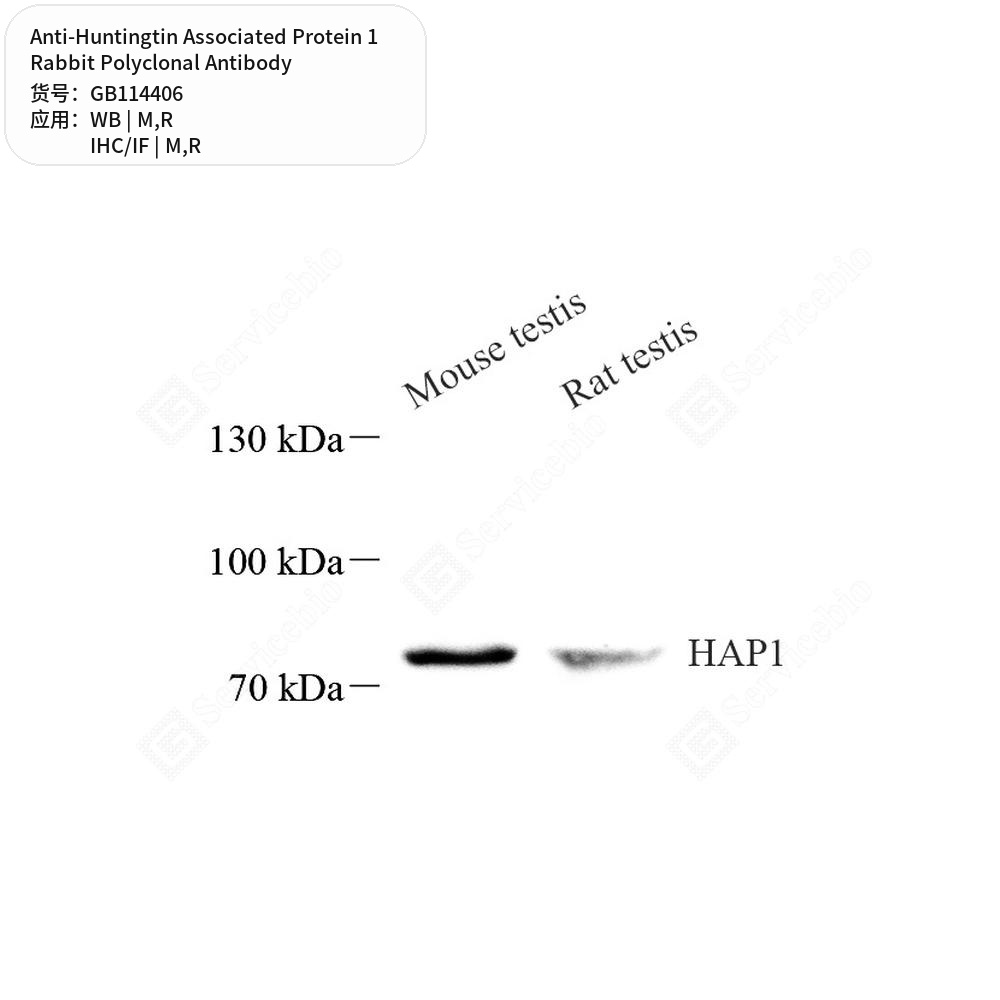 Антитела первичные, поликлональные кролика к Huntingtin Associated Protein 1 крысы, мыши, 50 мкл
