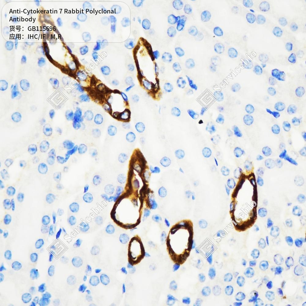 Антитела первичные, поликлональные кролика к Cytokeratin 7 крысы, мыши, 50 мкл