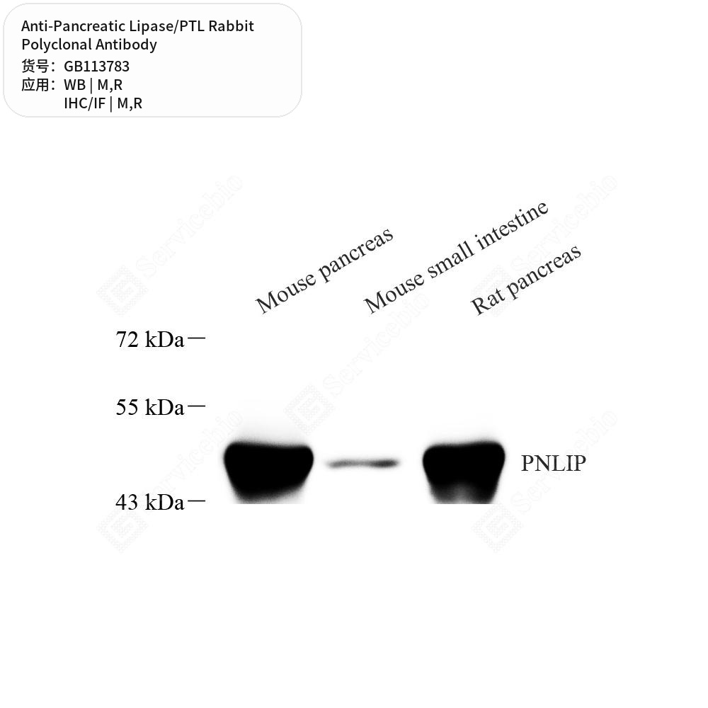 Антитела первичные, поликлональные кролика к Pancreatic Lipase/PTL крысы, мыши, 50 мкл