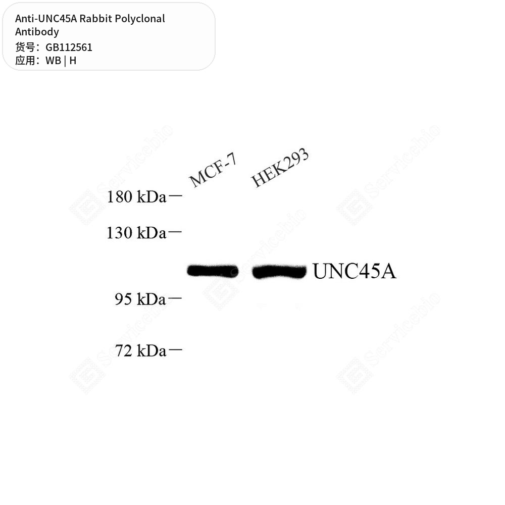 Антитела первичные, поликлональные кролика к UNC45A человека, 100 мкл